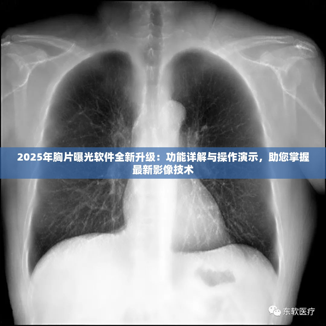 2025年胸片曝光软件全新升级：功能详解与操作演示，助您掌握最新影像技术